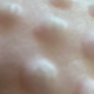 Pink bumpy fluffy ish material